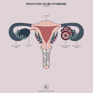 I have Polycystic Ovarian Syndrome... and I'm no longer being quiet about it!