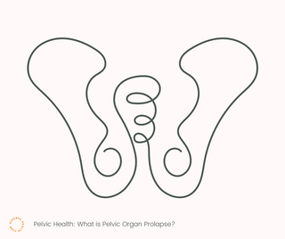 Pelvic Health: What is POP?