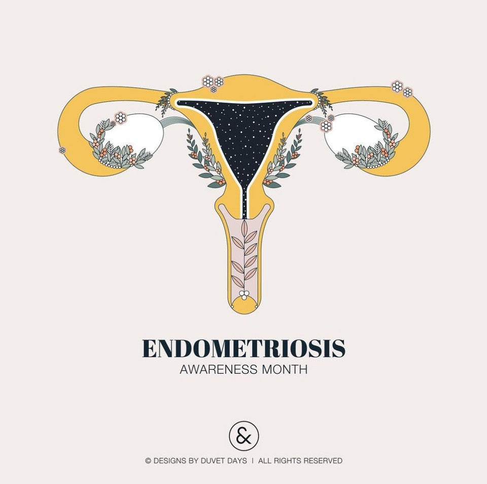Endometriosis Awareness: What You Need To Know